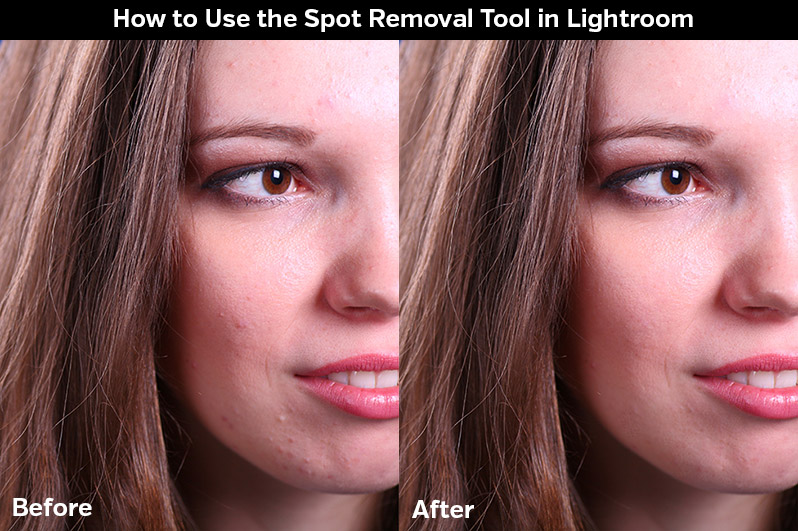 How to Use the Spot Removal Tool in Lightroom
